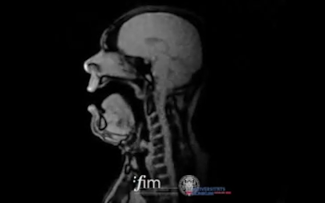 Singing in an MRI Machine Vocal Science